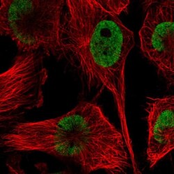 HNRPDL Antibody, Novus Biologicals:Antibodies:Primary Antibodies
